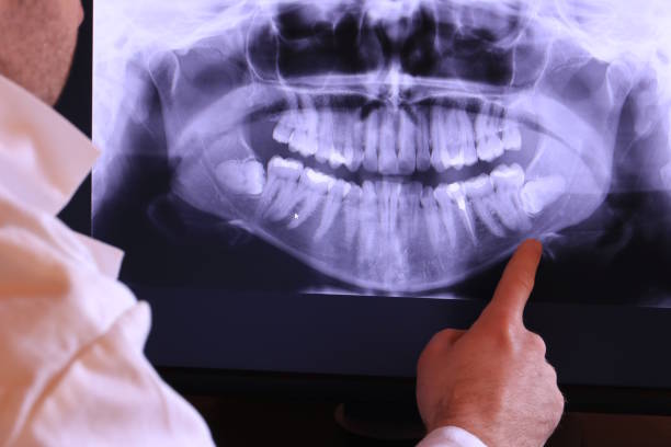 Best Knocked-Out Tooth Emergency  in Keeseville, NY